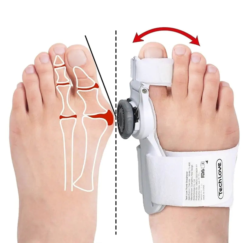 FLEXIBLE BUNION CORRECTOR