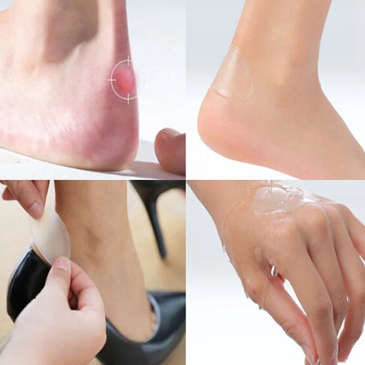 Better Blister Bandages