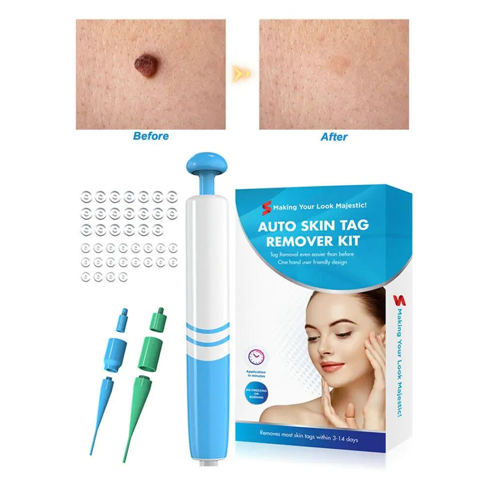 Fast Auto Tag Removal Kit