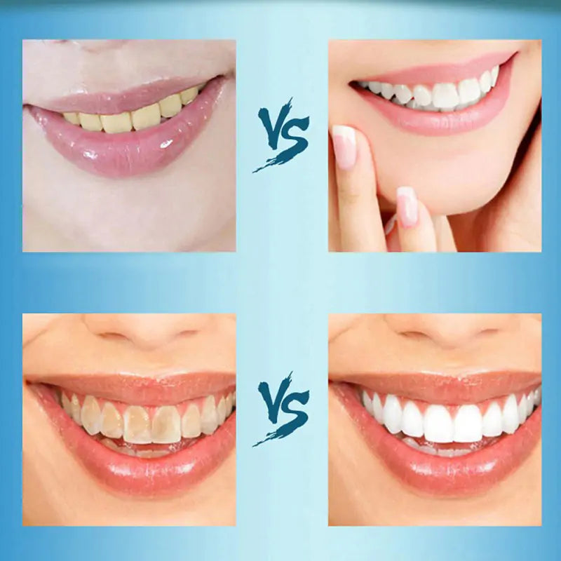 TEETH WHITENING CHARCOAL POWDER