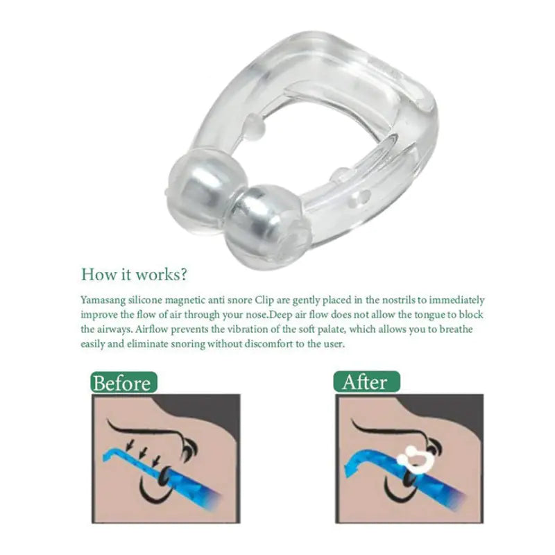 Anti Snoring Devices