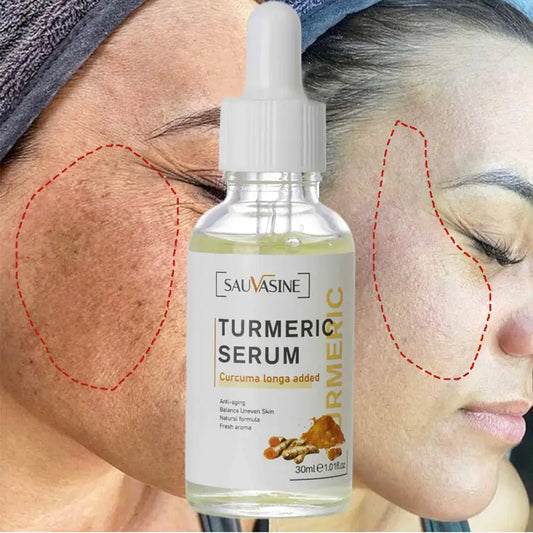 NATURAL SPOTS FREE SERUM