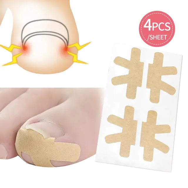 50 PCS Fertoe™ Toenail Corrector Patch