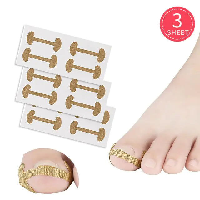 50 PCS Fertoe™ Toenail Corrector Patch