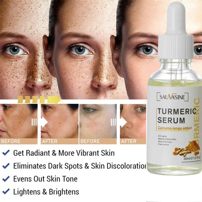 NATURAL SPOTS FREE SERUM